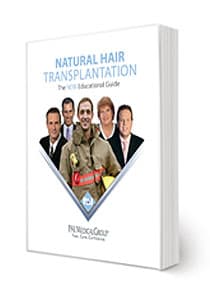 Guide to hair Transplants