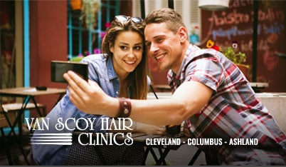 hair loss restoration replacement cleveland columbus ashland ohio