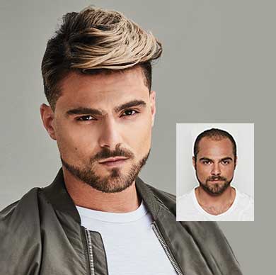 mens non-surgical hair restoration ashland columbus cleveland Ohio