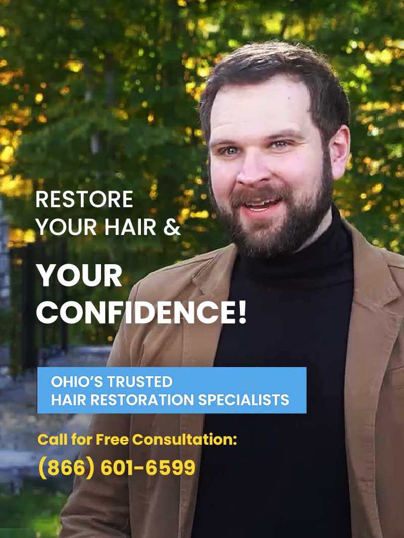 hair loss restoration transplants cleveland ashland columbus ohio
