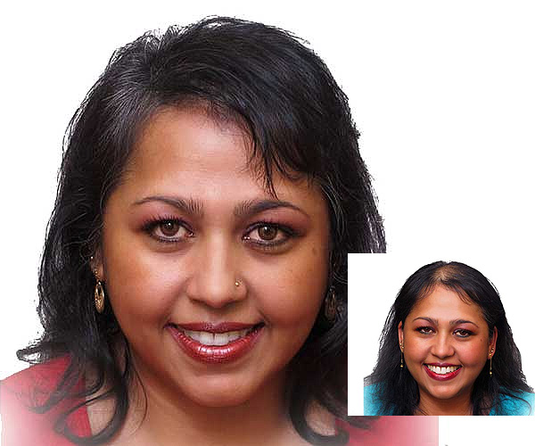 Scalp Micropigmentation for women - Ohio