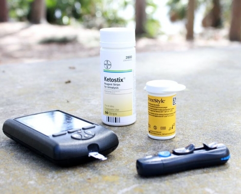 diabetes hair loss