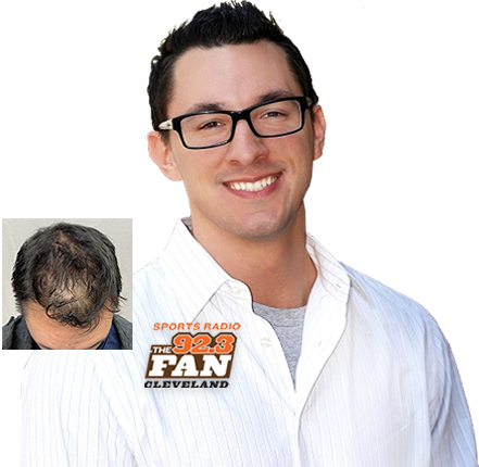 Anthony Lima PRP Hair Loss Restoration Treatment Cleveland Ohio