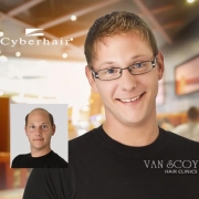 cyberhair mens hair replacement ohio