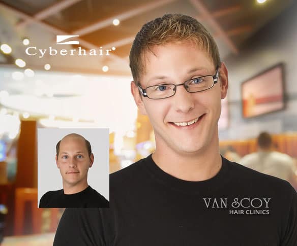 cyberhair mens hair replacement ohio