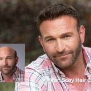 non-surgical mens hair replacement ashland ohio