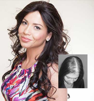 hair salon for hair loss cleveland columbus ashland ohio