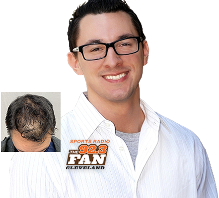 Enhanced Hair Loss Treatment Therapy Ohio